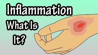 Inflammation - Inflammatory Response - What Is Inflammation In The Body?