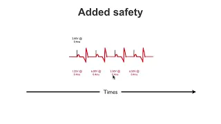 Common pacemaker problems part 1  Failure to capture