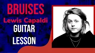 Bruises - Lewis Capaldi (Guitar Tutorial)