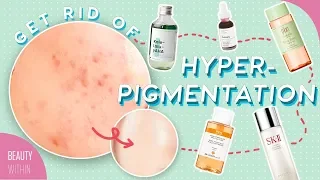 Best Ways to Reduce Hyperpigmentation & Dark Spots: Ingredients, Products & Natural Remedies
