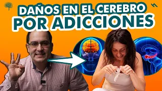 Daños En El Cerebro Por Adicciones - Juan Camilo Psicologo