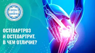 👉 Остеоартроз и остеоартрит. В чем отличие?