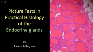 Picture test in histology of the endocrine glands