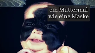 Sie machen sich über Baby lustig, das durch ein Muttermal wie „Batman“ aussieht!!!