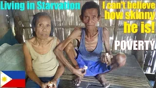 The Skinniest Filipino Man of the Philippines. These Poor Filipinos are Starving. Living in Poverty