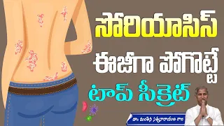 Wheatgrass Juice | How to Cure Psoriasis | Skin Allergy Treatment | Manthena Satyanarayana Raju