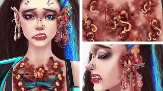 ASMR｜Treatment of barmaids with infected piercing sites｜Please be careful with skin piercings!