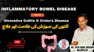 Inflammatory Bowel Disease (IBD), Ulcerative Colitis & Crohn’s Disease