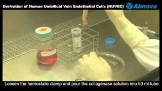 Derivation of Human Umbilical Vein Endothelial Cells (HUVEC)