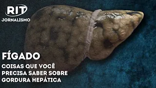 Gordura no Fígado: os principais sintomas da esteatose hepática