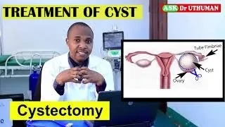 OVARIAN CYSTS, CAUSES, SIGNS, TREATMENT, can i get pregnant,menstruate with a cyst, CAN I CONCEIVE?