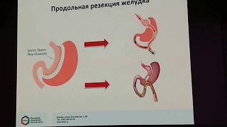 Повторные операции в бариатрической  хирургии