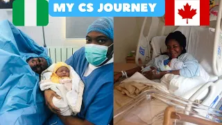 My CESAREAN section journey, 3 time birth experience from canada to nigeria the full story #delivery