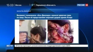 Новый вброс: девочку, раненную солдатами Асада, загримировали в Аль-Джазире