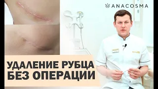 ⚠️Лазерная шлифовка шрамов ⚠️Лазерное удаление рубцов 🔥 ОПАСНО?🔥 | Миронов Андрей