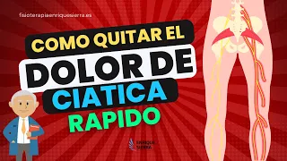 COMO QUITAR EL DOLOR DE CIÁTICA RÁPIDO 💥