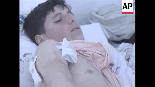 Kosovo - Survivor of massacre