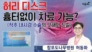 '나이가 많아도 디스크 수술 가능하다?'  척추 내시경 수술의 오해와 진실 (feat. 디스크 예방법) - 참포도나무병원 허동화 원장