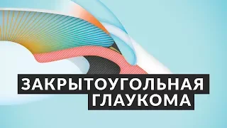 👁️ ОТ ЭТОГО МОЖНО ОСЛЕПНУТЬ! 👁️ Закрытоугольная глаукома: симптомы, причины, лечение Доктор Лапочкин