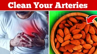 8 Foods To Clear Blocked Arteries Without Surgery | Clogged Arteries Treatment