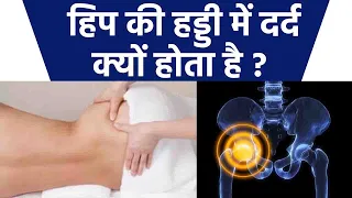 हिप की हड्डी में दर्द क्यों होता है | Hip Bone Mein Dard Kyu Hota Hai | Boldsky *Health