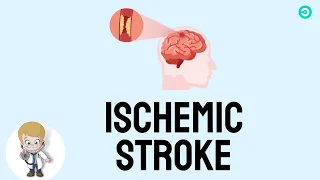 Ischemic Stroke: A Comprehensive Guide to Signs, types, and Treatment