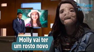 Reconstrução facial para Molly | Capítulo 14 | Temporada 2 | The Good Doctor em Português