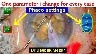 What is the one Parameter I change for every case..?-Dr Deepak Megur