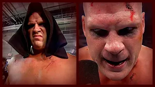 A Bruised & Battered Kane Warns Shane McMahon About Survivor Series! 10/20/03