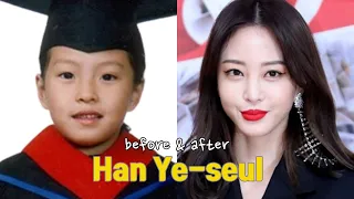 Han Ye-seul before and after
