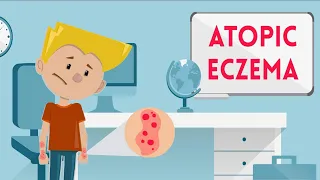 Atopic Eczema