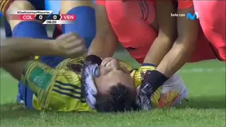 ⚠️TERRIBLE LESIÓN de Santiago Arias | COLOMBIA vs VENEZUELA | 09 de octubre 2020| ELIMINATORIAS