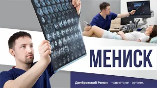 Разрыв мениска. Лечить или оперировать? Отзыв пациентки.