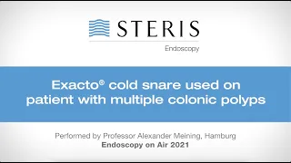 Endoscopy On Air | Professor Alexander Meining: EXACTO™ Cold Snare on Multiple Colonic Polyps