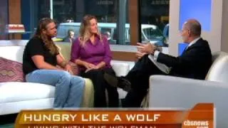 Real-Life Wolfman