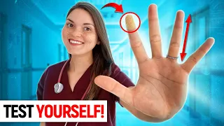 What your HANDS say about your HEALTH: Doctor Explains