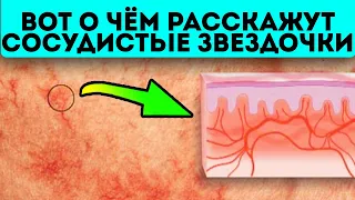 Не спеши бежать к хирургу! Эти простые средства уберегут тебя от скальпеля