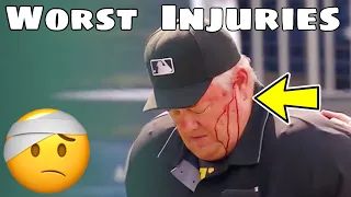 MLB | Interesting Injuries Super Cut