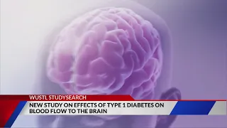 Wash U to launch new study on Type 1 diabetes