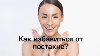 КАК ИЗБАВИТЬСЯ ОТ ПОСТАКНЕ - ТОЛЬКО РЕАЛЬНО РАБОТАЮЩИЕ СПОСОБЫ!