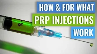 How do PRP injections work?