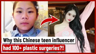 Why this Chinese teen influencer had 100+ plastic surgeries?!