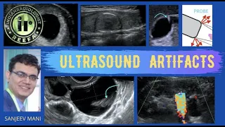 ULTRASOUND ARTIFACTS | Sonography Tutorial | Dr Sanjeev Mani | Exam Question in Radiology