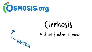 Cirrhosis Overview | Clinical Presentation