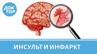 Какая разница между инсультом и инфарктом, что такое микроинсульт