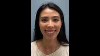 Before Brisbane dermal filler treatment: gummy smile