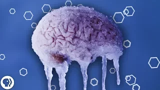 Why do You Get a Brain Freeze?