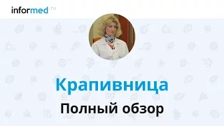 Крапивница: обзор, симптомы, диагностика, лечение, профилактика.