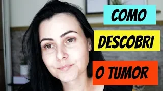 TUMOR NO FÍGADO