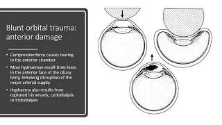 Ocular trauma